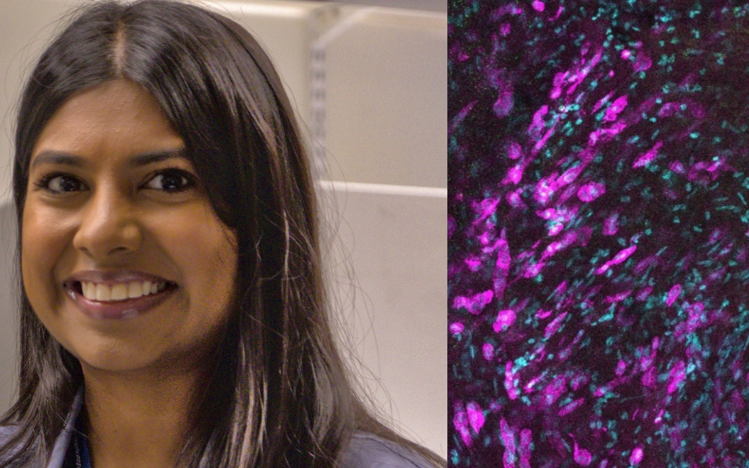 Targeting pleural immune cells to treat bacterial infections and improve lung transplant outcomes